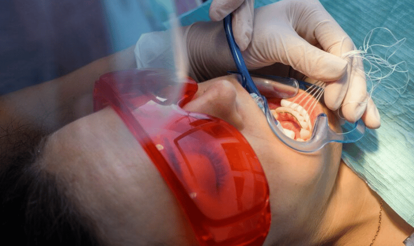 Myths about Root Canal Treatment