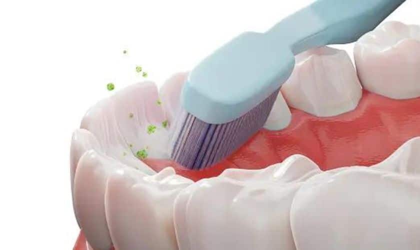 Preventing tooth decay