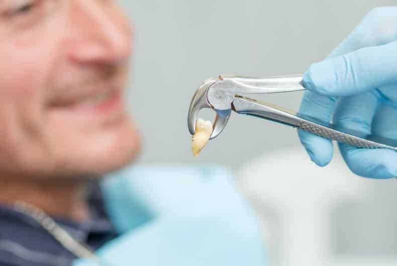 Things to avoid after tooth extraction