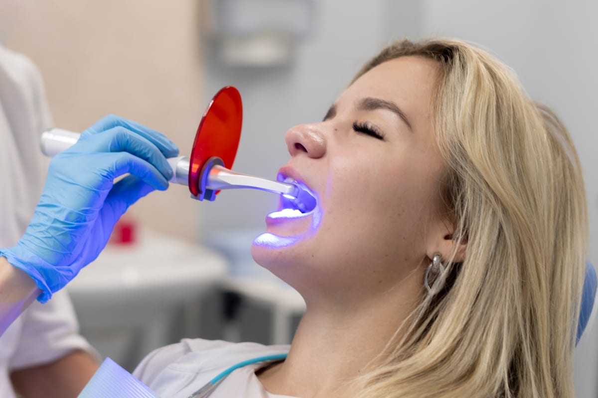 Featured image for “Teeth Whitening in Fenton, MI | Downtown Dental Fenton”